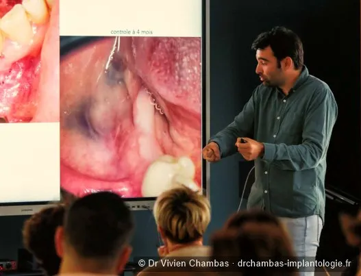 Le Dr Vivien Chambas enseignant l’implantologie à des confrères